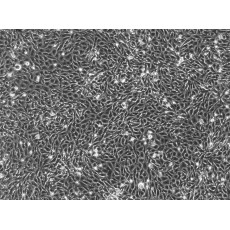 Porcine Aorta Endothelial Cells (PAEC)